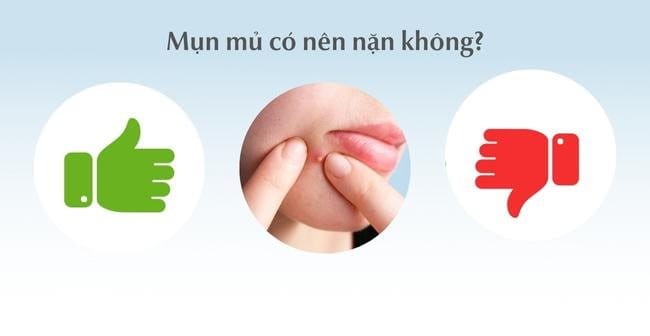 Có nên nặn mụn mủ không?