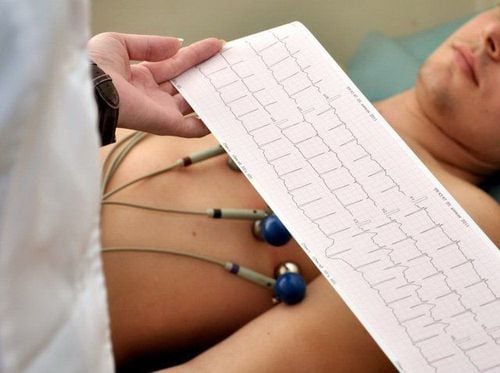 Điện tâm đồ (ECG) giúp bác sĩ chẩn đoán bệnh rung nhĩ