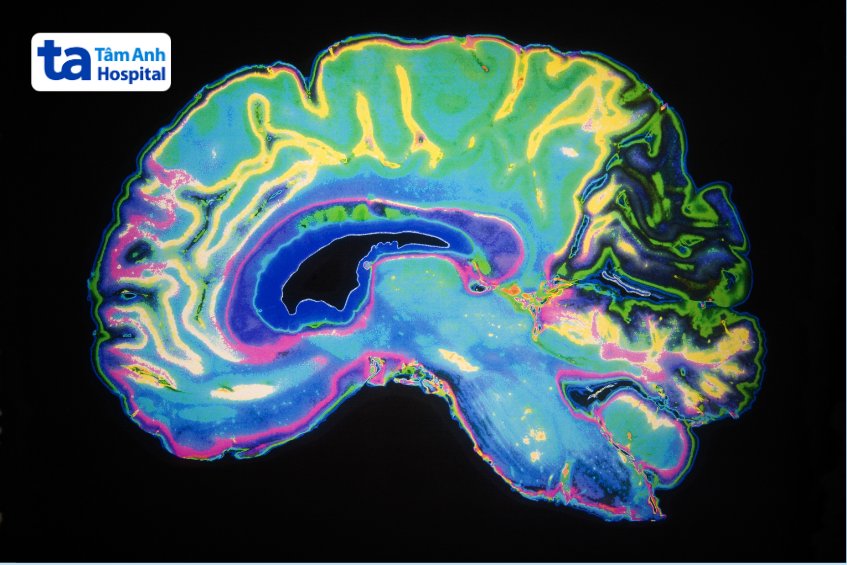 hình chụp mri phổ màu chức năng não bộ