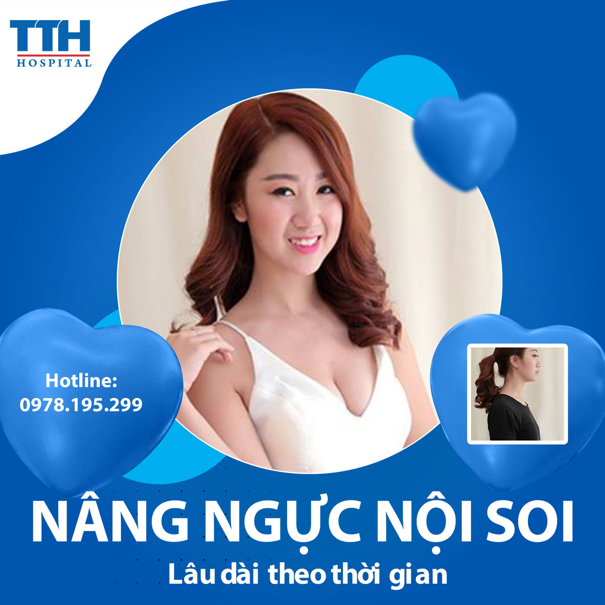 nâng ngực nội soi