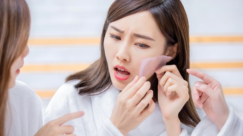 Niacinamide sẽ giúp ngăn chặn sự hoạt động quá mức của các tuyến bã nhờn