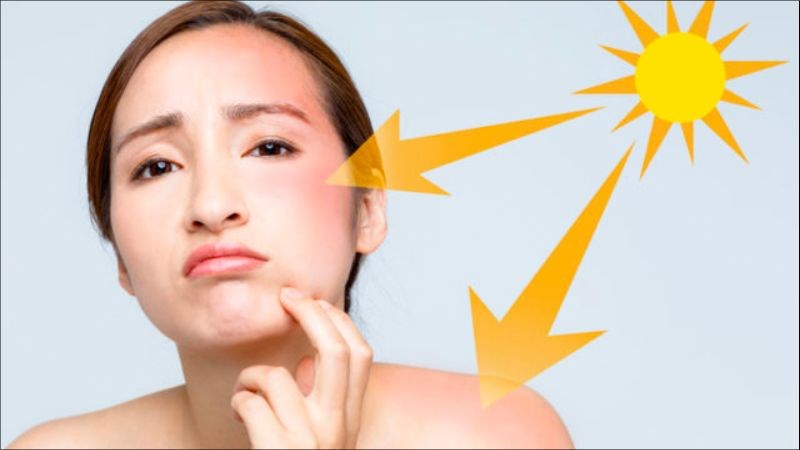 Niacinamide giúp da khoẻ hơn tăng khả năng chống chịu với tia UV