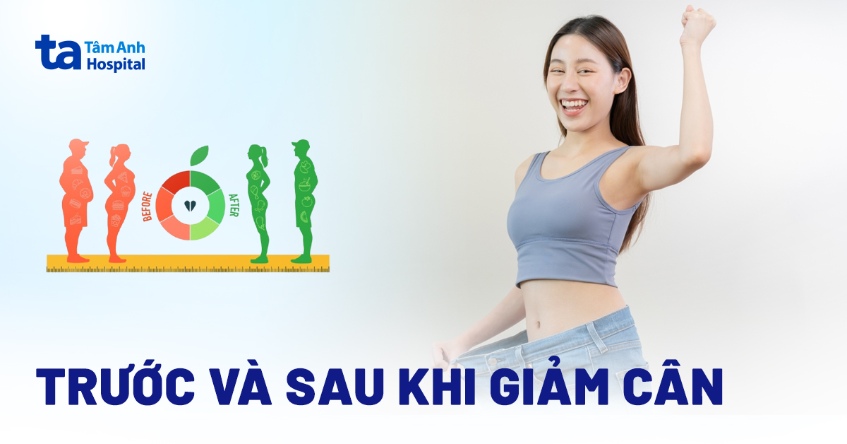 trước và sau khi giảm cân