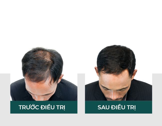 Kiểu tóc ngắn nam đẹp Trung Quốc