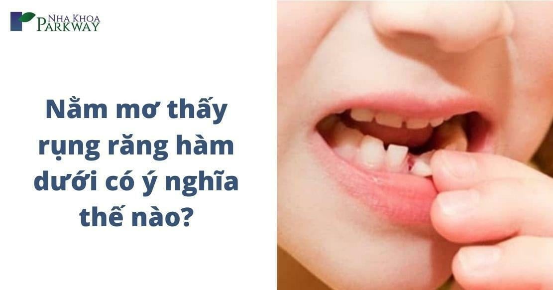 Nằm mơ thấy rụng răng hàm dưới - 1