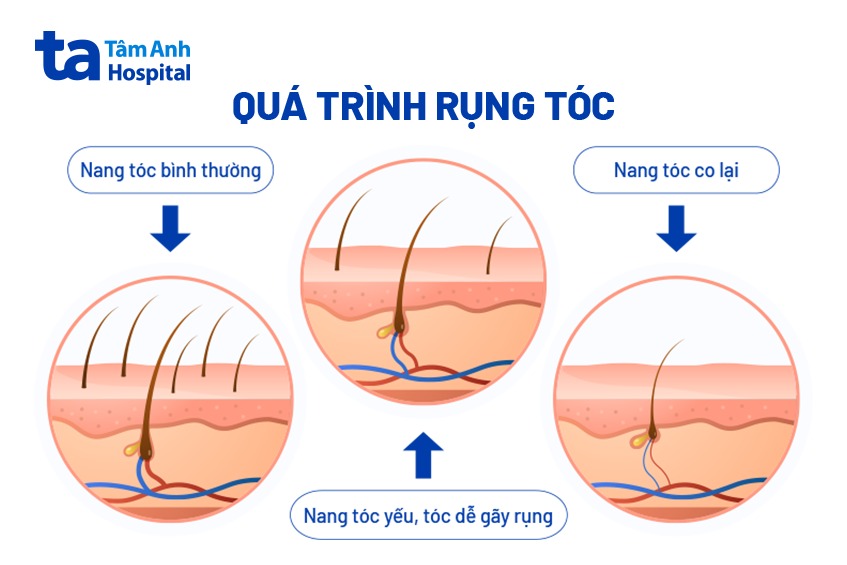 quá trình rụng tóc