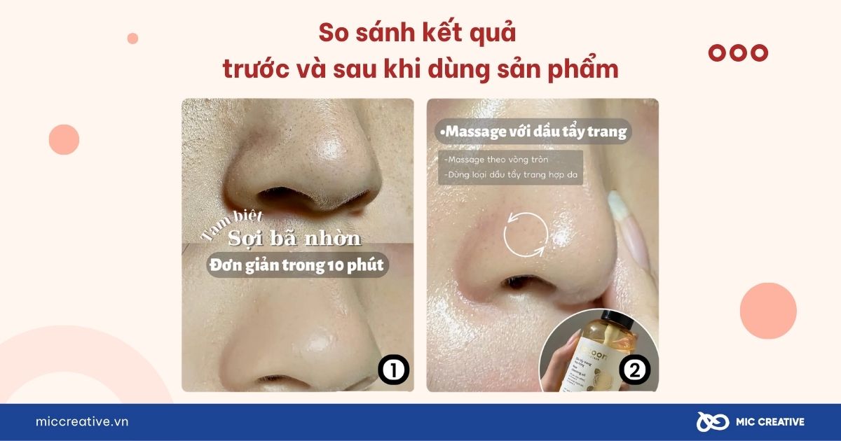 So sánh kết quả trước và sau khi dùng sản phẩm