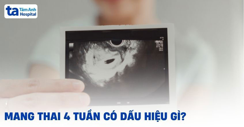 mang thai 4 tuần có dấu hiệu gì