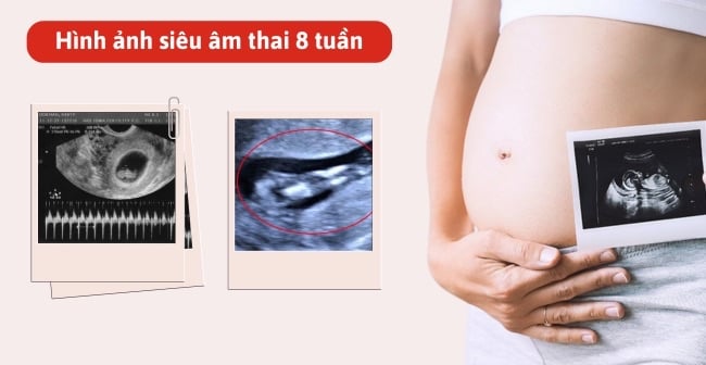 Hình ảnh thai nhi 8 tuần tuổi