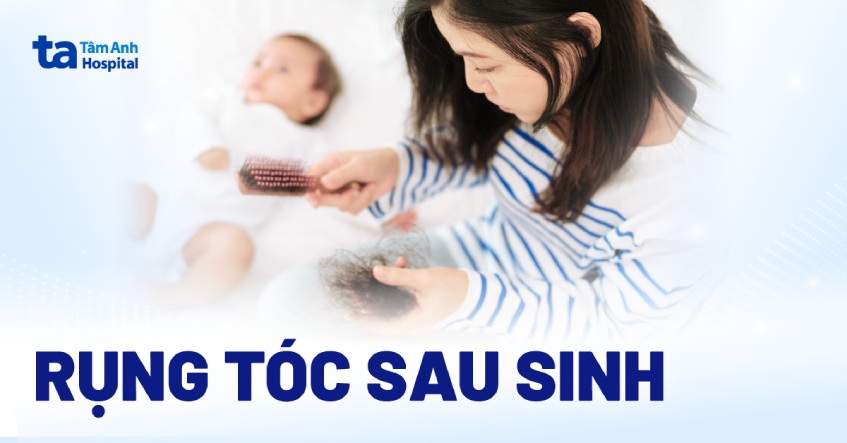 rụng tóc sau sinh