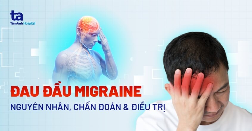 đau đầu migraine