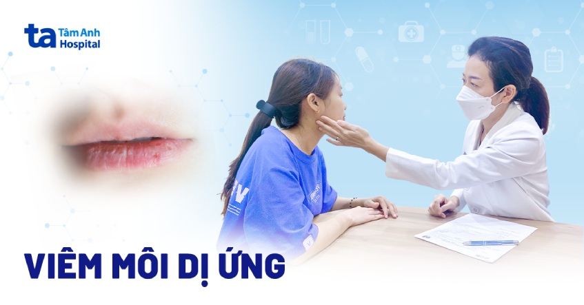 viêm môi dị ứng