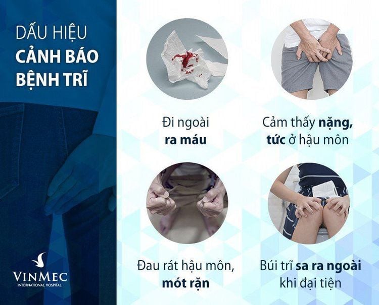 Các dấu hiệu cảnh báo bệnh trĩ